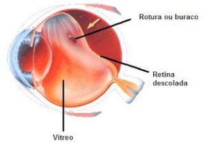 b_300_0_16777215_00_http___4.bp.blogspot.com__VvIfDfPWhLw_TNCg6BubUtI_AAAAAAAAAkc_rPIZrJ-tHS0_s320_DR_rotura.jpg
