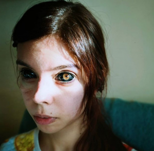 Modelo polonesa perde parcialmente a visão após procedimento estético para tingir seus olhos de preto — Foto: Reprodução/Instagram/anoxi_cime