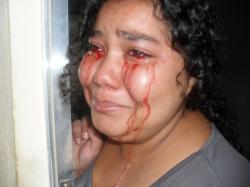 Menina chora sangue no interior de São Paulo