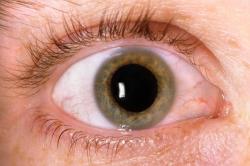 Maio Verde alerta sobre a prevenção e combate ao glaucoma
