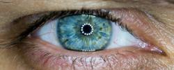 Terapia experimental melhorou visão de pessoas com cegueira rara