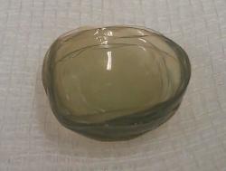 Médica encontra 27 lentes de contato perdidas em olho de paciente Médica encontra 27 lentes de contato perdidas em olho de paciente