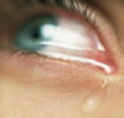Lágrimas em excesso - os problemas que isso pode ocasionar nos bebês