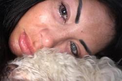 Modelo perde visão após cirurgia para mudar a cor dos olhos Modelo perde visão após cirurgia para mudar a cor dos olhos