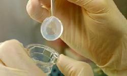 Córnea artificial elimina necessidade de transplante