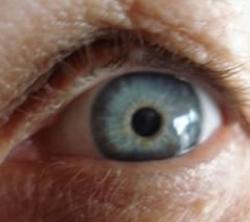 Glaucoma: Doença silenciosa que causa cegueira