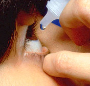 O tratamento mais conhecido para olho seco é a estilação de colírios